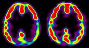 Left brain on left;  right brain on right....or is it the other way around?